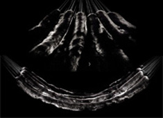 Fox Fur Double Hammock by Bless Studio 