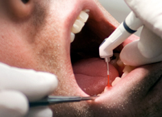 German Laser Dentist