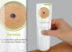 Detector VS Black Skin Cancer