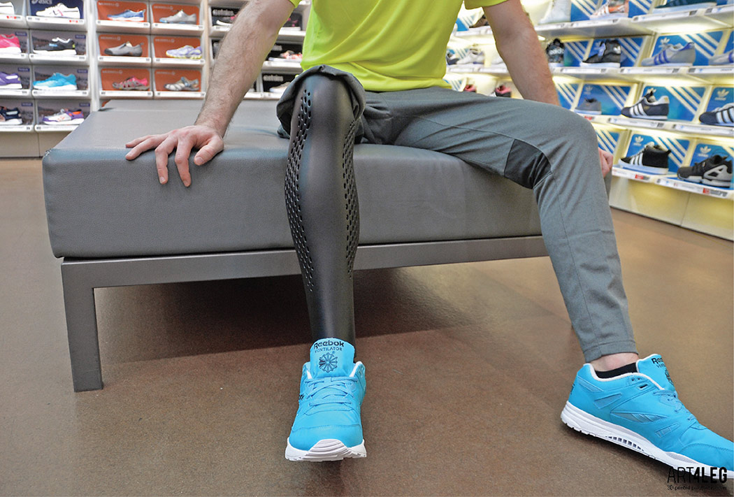 3D Printed Prosthetic Masterpieces Yanko Design