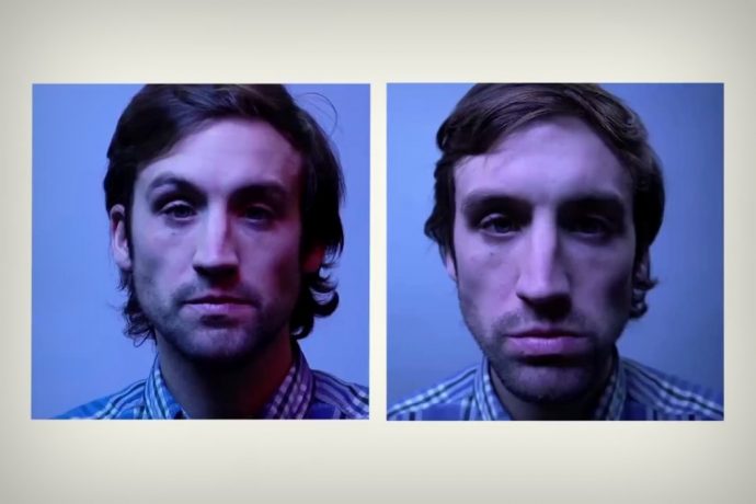 How the selfie camera is driving people to get nose-jobs