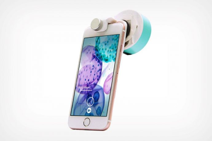 The uHandy Duet lets your smartphone’s fancy camera click microscopic shots too
