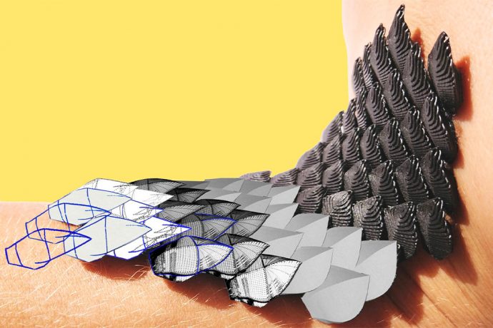 This wearable cast revolutionizes healthcare by protecting and healing injuries without sacrificing mobility!