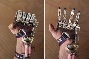 Engineer designed and built his own functioning mechanical prosthetic hand and it looks like a steampunk beauty!