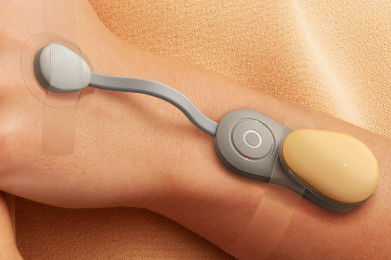 This wearable gadget measures skin oxygen levels to detect and