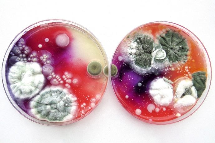 You won’t believe that these psychedelic art pieces are actually close-ups of molds and fungi!