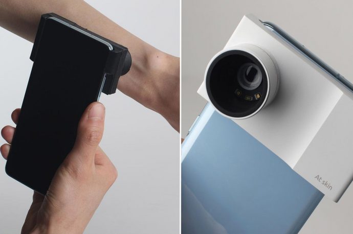 This smartphone accessory scans your skin for underlying problems, the hassle-free way