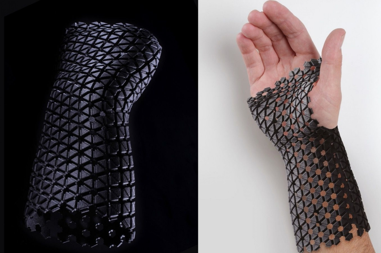 #Medical cast concept uses recycled materials and sustainable methods