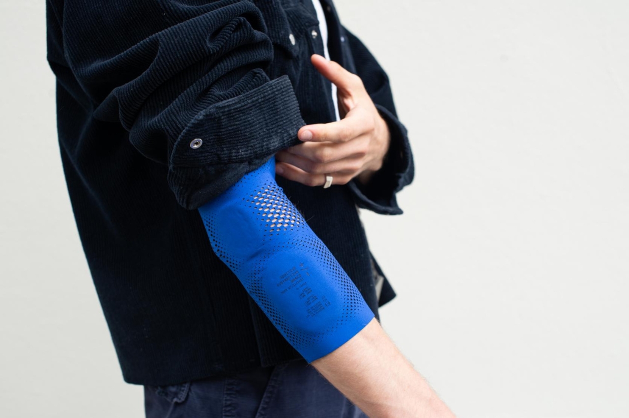 #3D printed elbow brace can be customized and created through an app