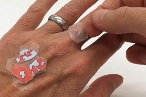 Transparent skin patches promise psoriasis patients better human-centered treatment