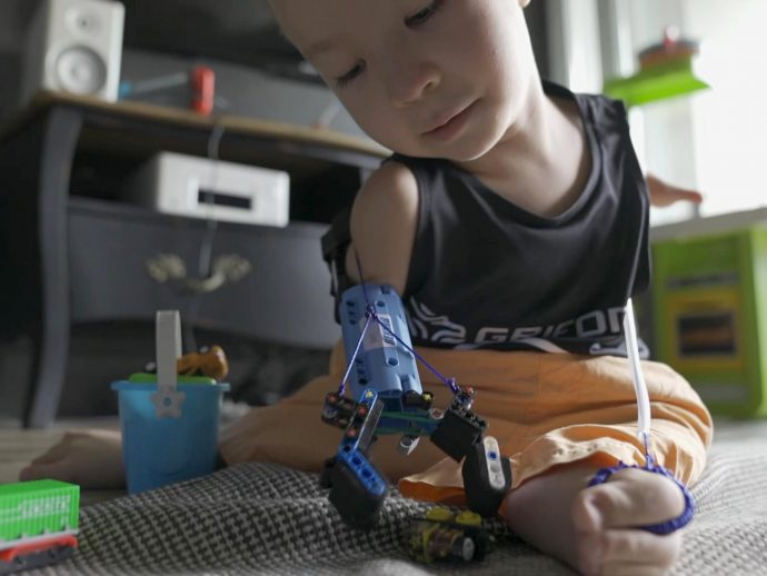 LEGO Prosthetic Arm Empowers 8-Year Old with Affordable Accessible Healthcare