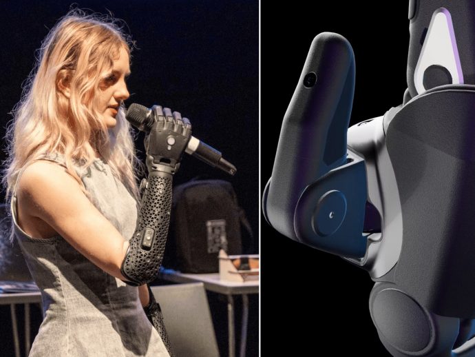 Wireless bionic arm with detachable hand that crawls on its own is boon for prosthetics dependents