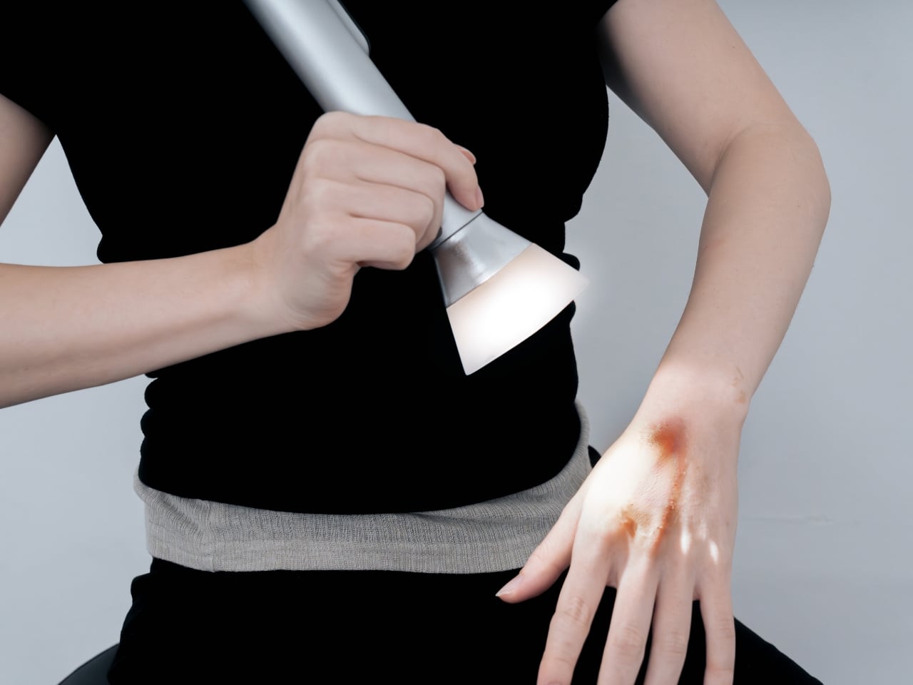 Smart Healing: A Concept For AI Powered Burn Treatment - Yanko Design