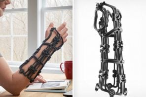 This Kevlar Medical Brace Folds Flat Like Origami and Might Finally Kill the Plaster Cast