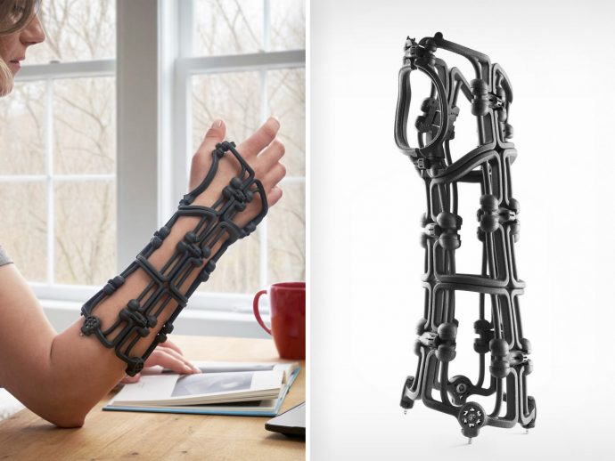 This Kevlar Medical Brace Folds Flat Like Origami and Might Finally Kill the Plaster Cast
