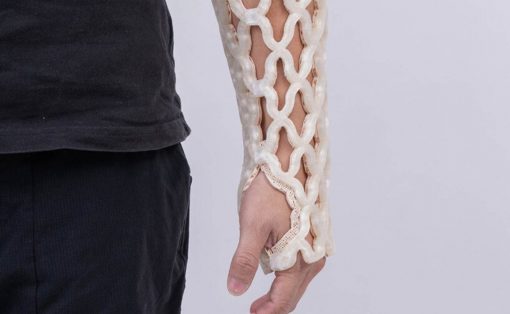 Forearm wrapped in a white lattice medical cast from wrist to mid-forearm.