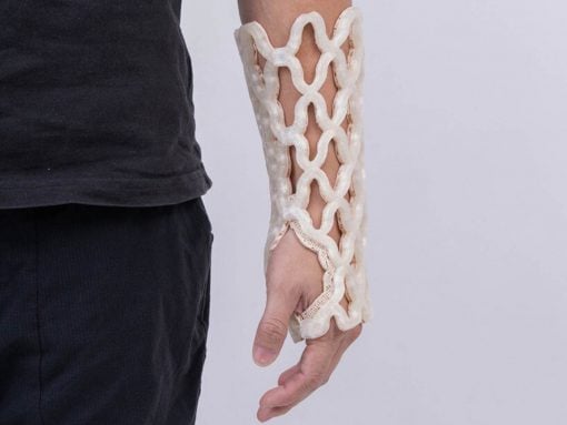 Forearm wrapped in a white lattice medical cast from wrist to mid-forearm.